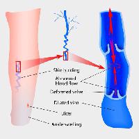 Pixwords Obraz z skóra, nogi, nogi, kostki, krwi, strzały, medyczne, medycyna Designua